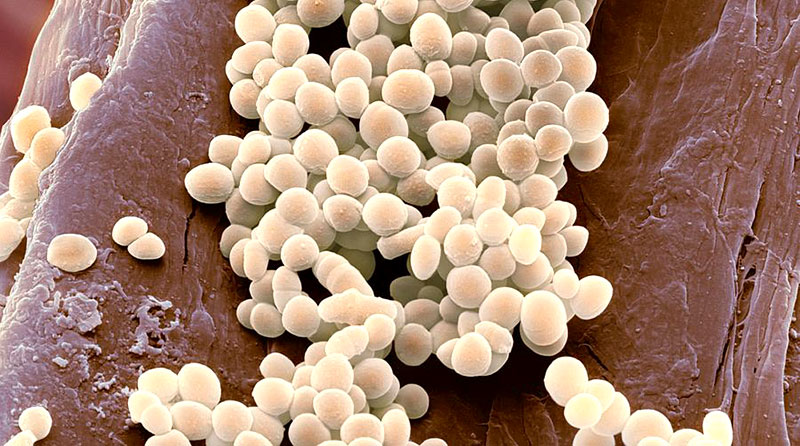 Lactococcus lactis
